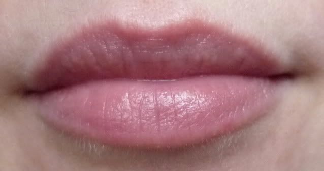 Dry Patch on Lip: Causes, Symptoms & Home Remedies